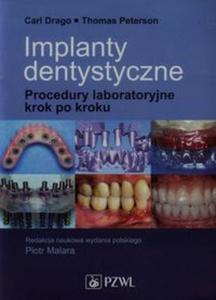 Implanty dentystyczne - 2857683031