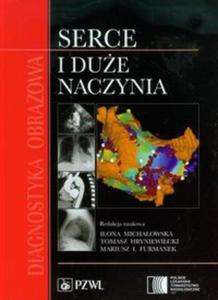 Diagnostyka obrazowa Serce i due naczynia - 2857700257