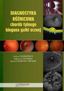 Diagnostyka rónicowa chorób tylnego bieguna gaki ocznej