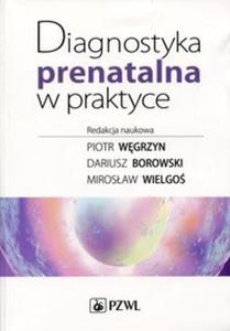 Diagnostyka prenatalna w praktyce - 2857732221