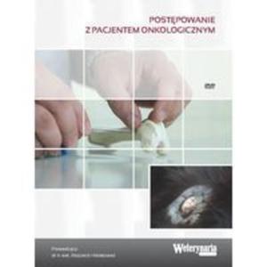 Postpowanie z pacjentem onkologicznym - 2857764600