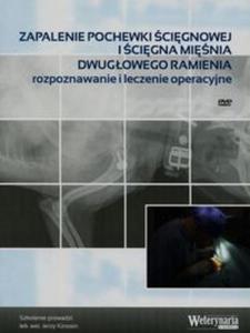 Zapalenie pochewki cignowej icigna minia dwugowego ramienia - 2857764612