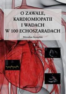 O zawale kardiomiopatii i wadach w 100 echoszaradach - 2857769992