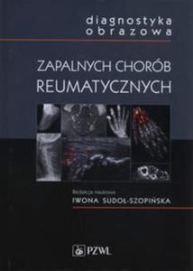 Diagnostyka obrazowa zapalnych chorb reumatycznych - 2857778631