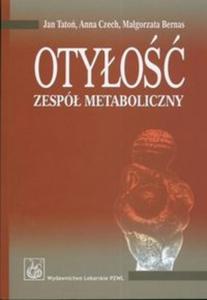 Otyo Zesp metaboliczny - 2825664731