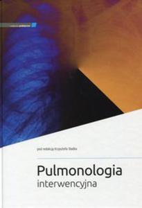 Pulmonologia interwencyjna - 2857781763