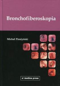 Bronchofiberoskopia - 2857787479