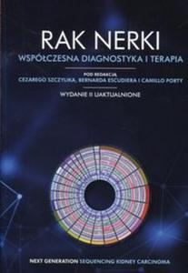 Rak nerki Wspóczesna diagnostyka i terapia