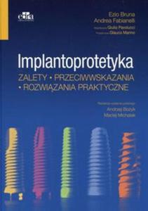 Implantoprotetyka Zalety przeciwwskazania rozwizania praktyczne - 2857832055