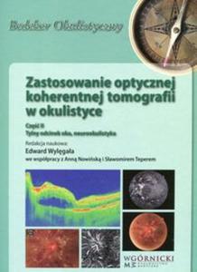 Zastosowanie optycznej koherentnej tomografii w okulistyce Część 2 - 2857839023