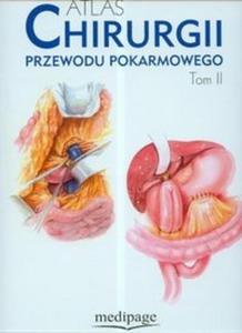 Atlas chirurgii przewodu pokarmowego t.2 - 2825677188