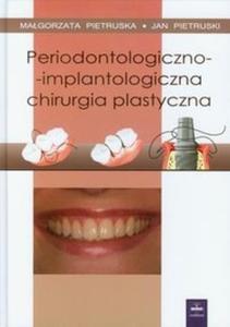 Periodontologiczno implantologiczna chirurgia plastyczna - 2825704063